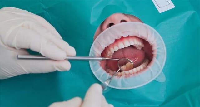 Анестезия и седация при имплантации: коротко и по делу