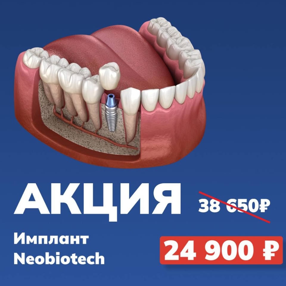 Не упустите момент